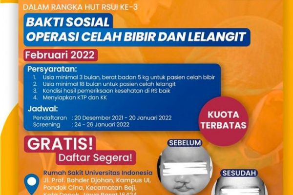 RSUI Mengadakan Bakti Sosial Operasi Bibir Sumbing, Gratis!!